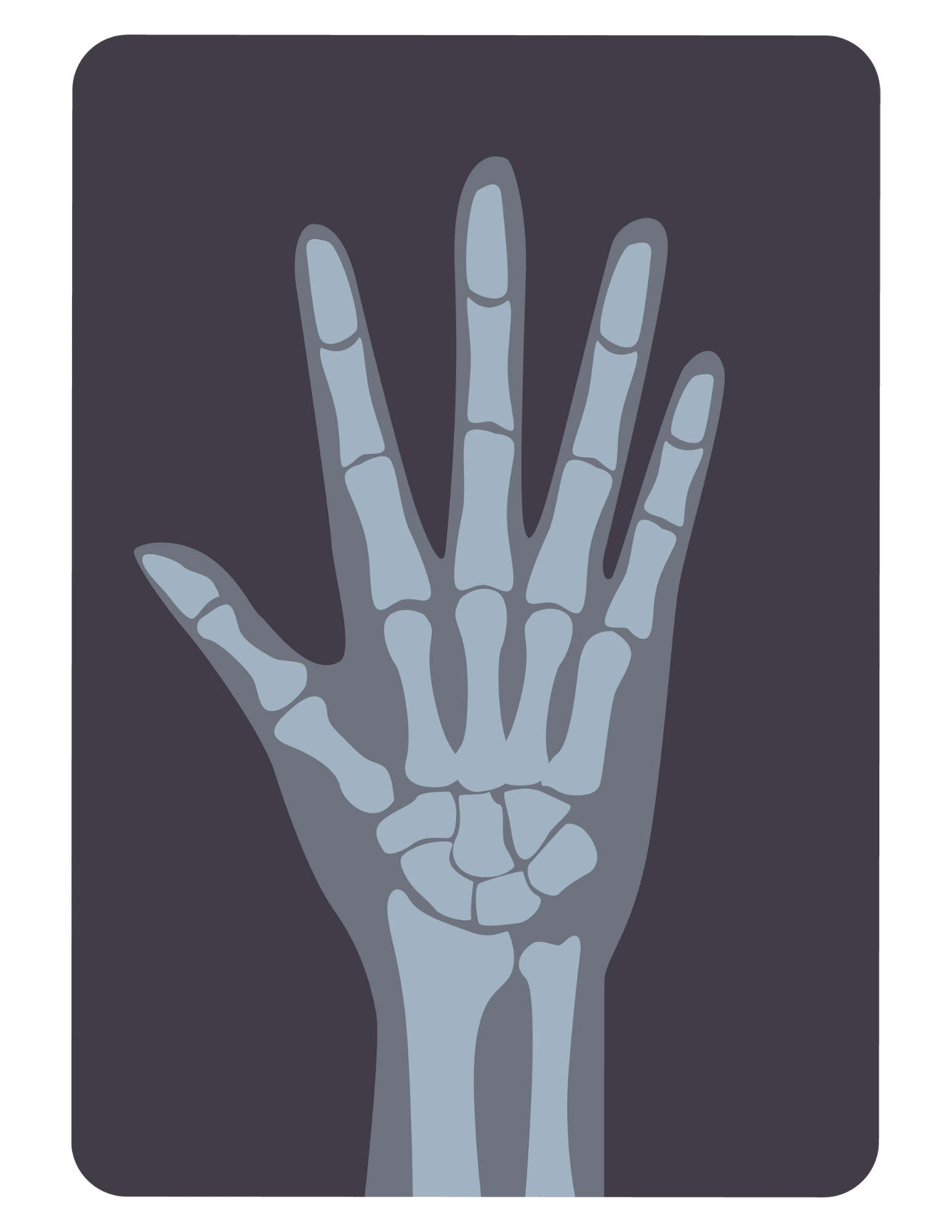 X-Ray Hand Pretend Doctor Play