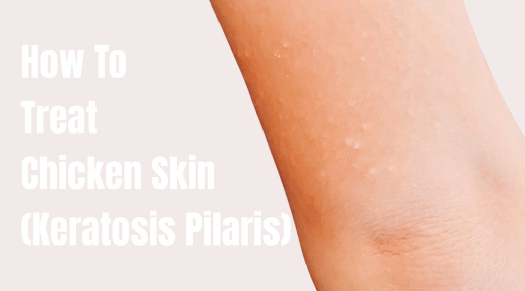 How to treat chicken skin (keratosis Pilaris)