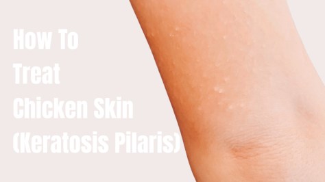 How to Get Rid of Chicken Skin (Keratosis Pilaris) in Children and Adults